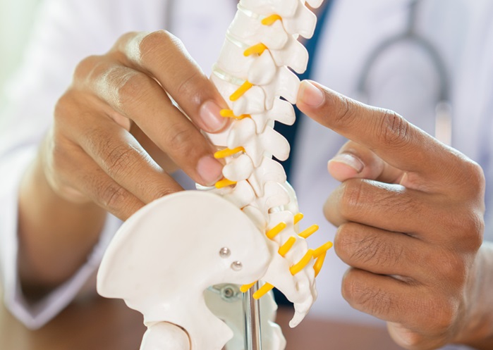 Doctor describing kyphoplasty to patient