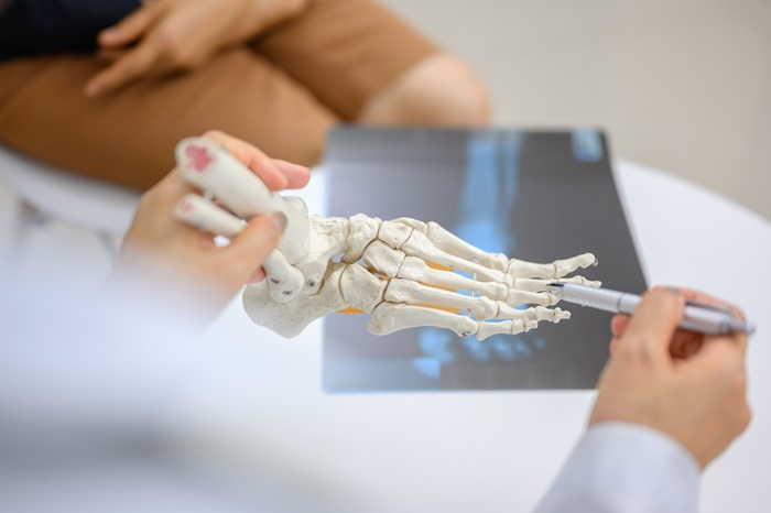 Close-up photo of an orthopedic doctor holding a model of ankle and foot bones explaining to a patient about foot bone problems. Concept of health care for feet and foot bones