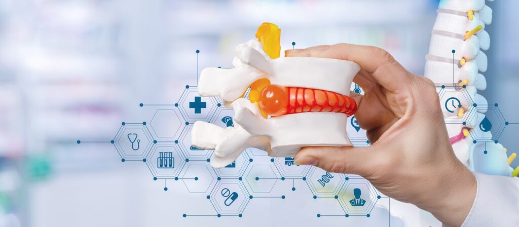 Herniated disc model