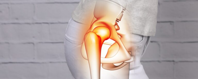 Woman with hip pain