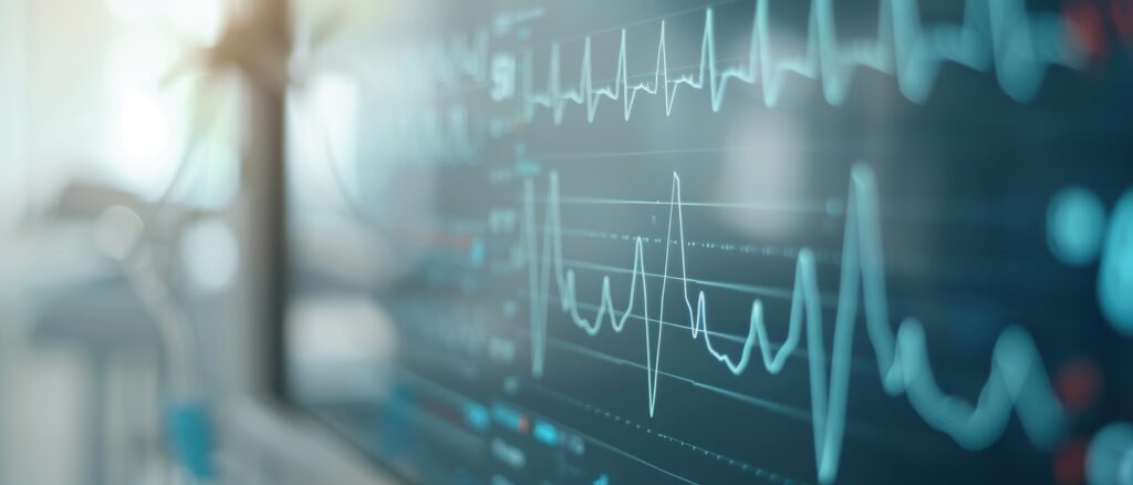 Heart rate variability data display