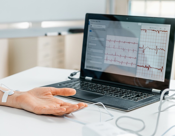 HRV data collection