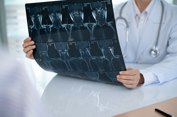 Surgeon reviewing cervical spine x-ray