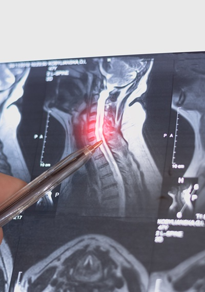 Doctor reviewing cervical x-ray