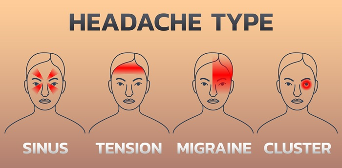 Types of headaches