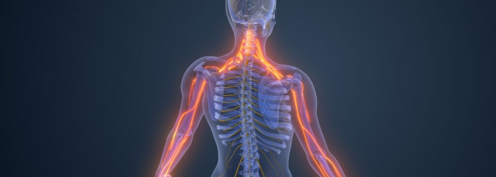 Cervical radiculopathy hero image