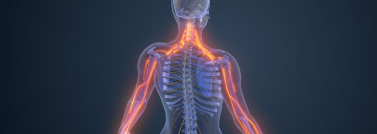 Cervical radiculopathy hero image