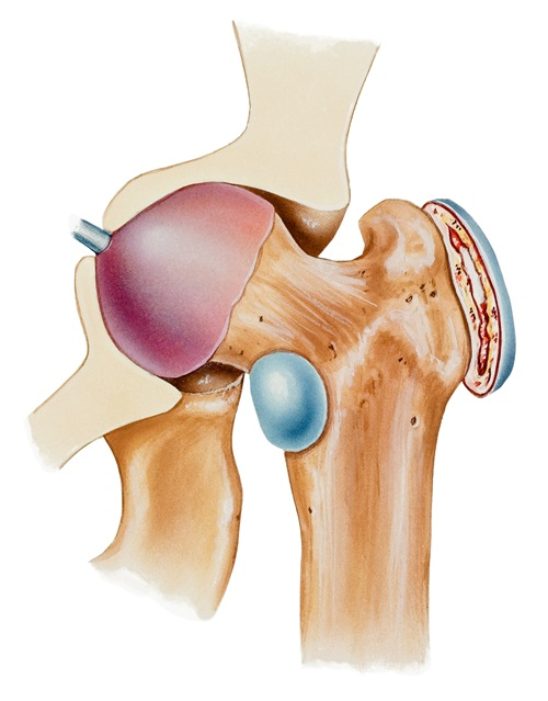 Diagram of hip bursa