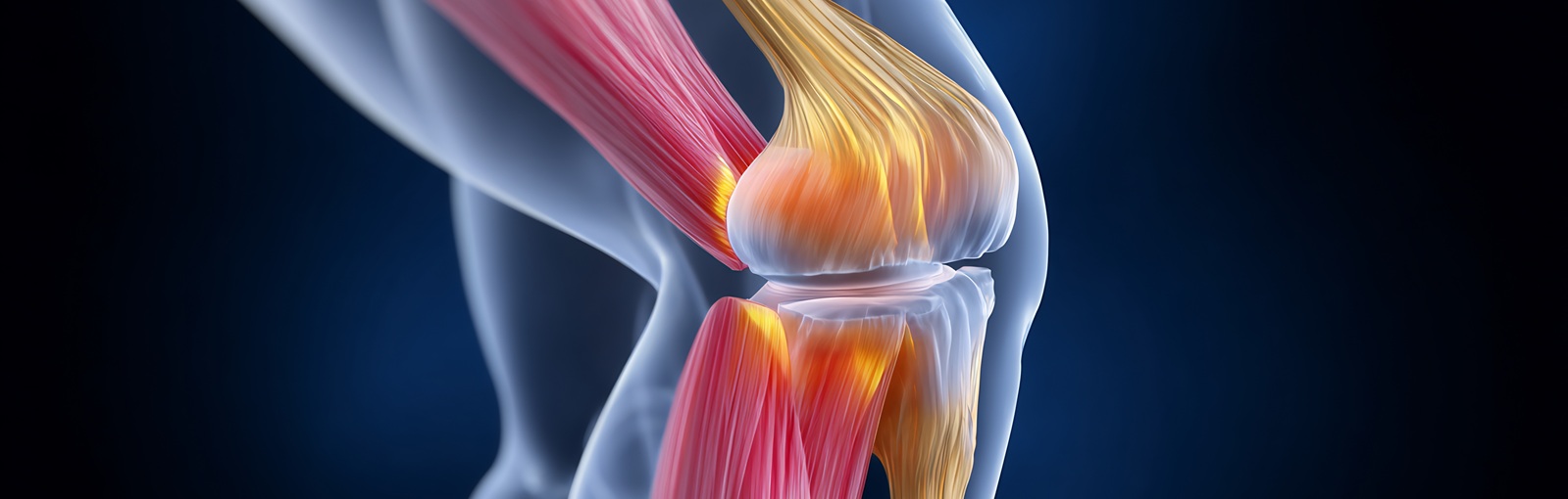 Patellar Tendonitis Symptoms, Causes & Treatment