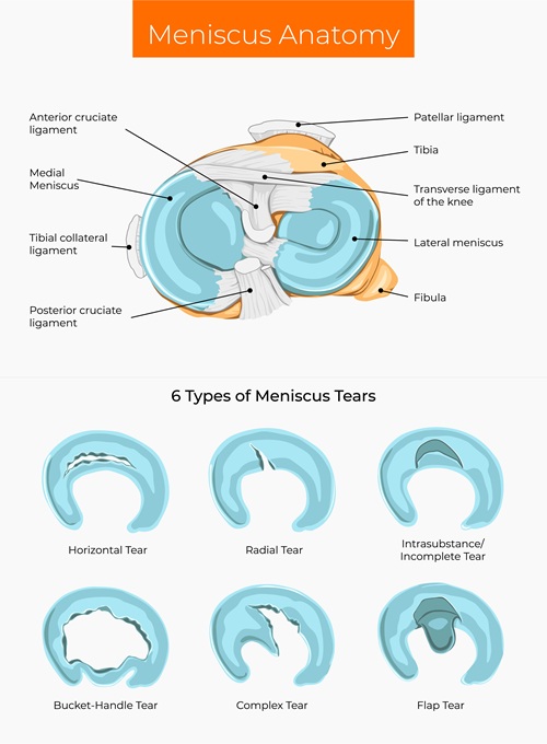Diagram of Meniscus anatomy