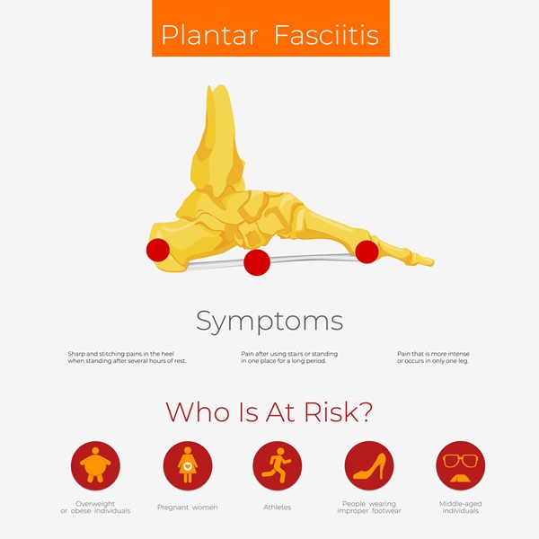 Plantar fasciitis symptoms and risk factors diagram