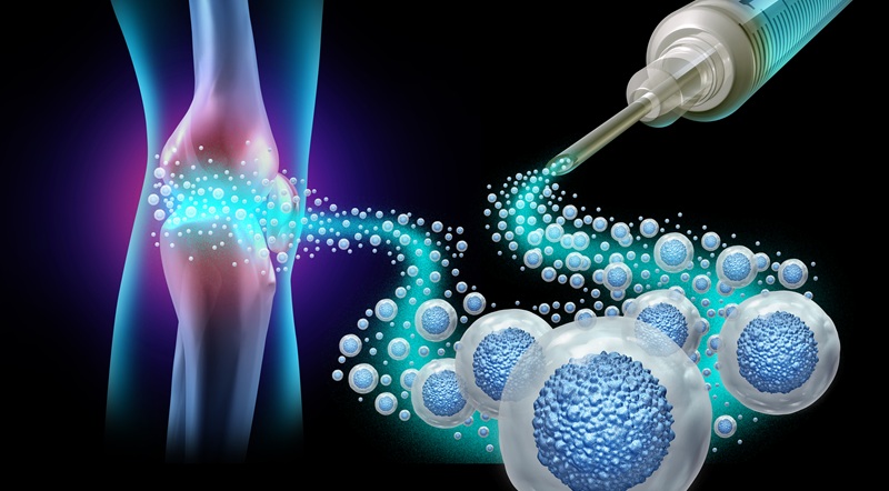 Regenerative medicine for knee pain