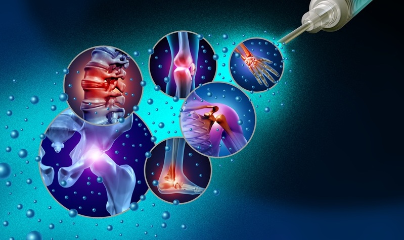 Stem cell injections