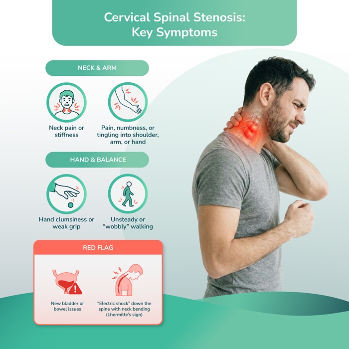 Cervical spinal stenosis symptoms