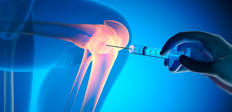 Gel Knee Injection